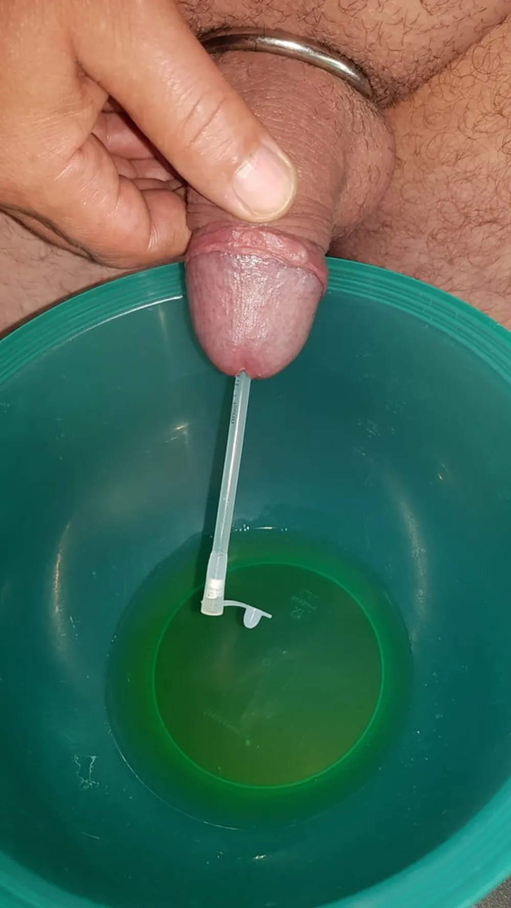 Catheter sounding with my urine #4