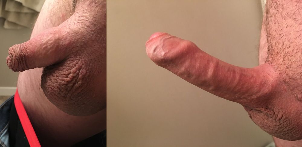 Me and my Penis #33