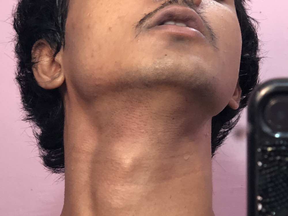 Pics of my slim  body  #20