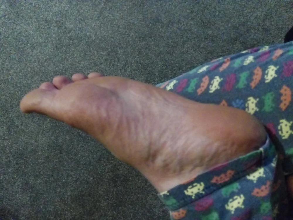 Feet Pics #6