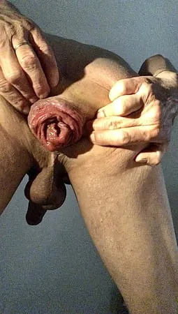 anal dilation sloppy anal         