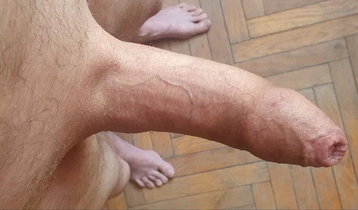 My Cock #11