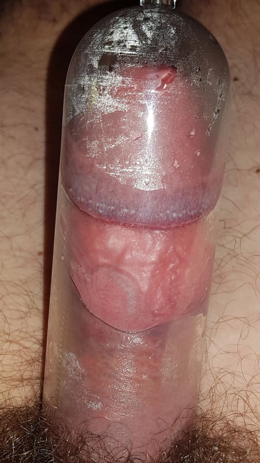 Penis pump #37