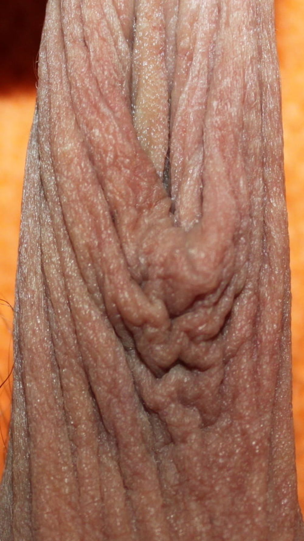 My foreskin #22