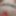 Teasers