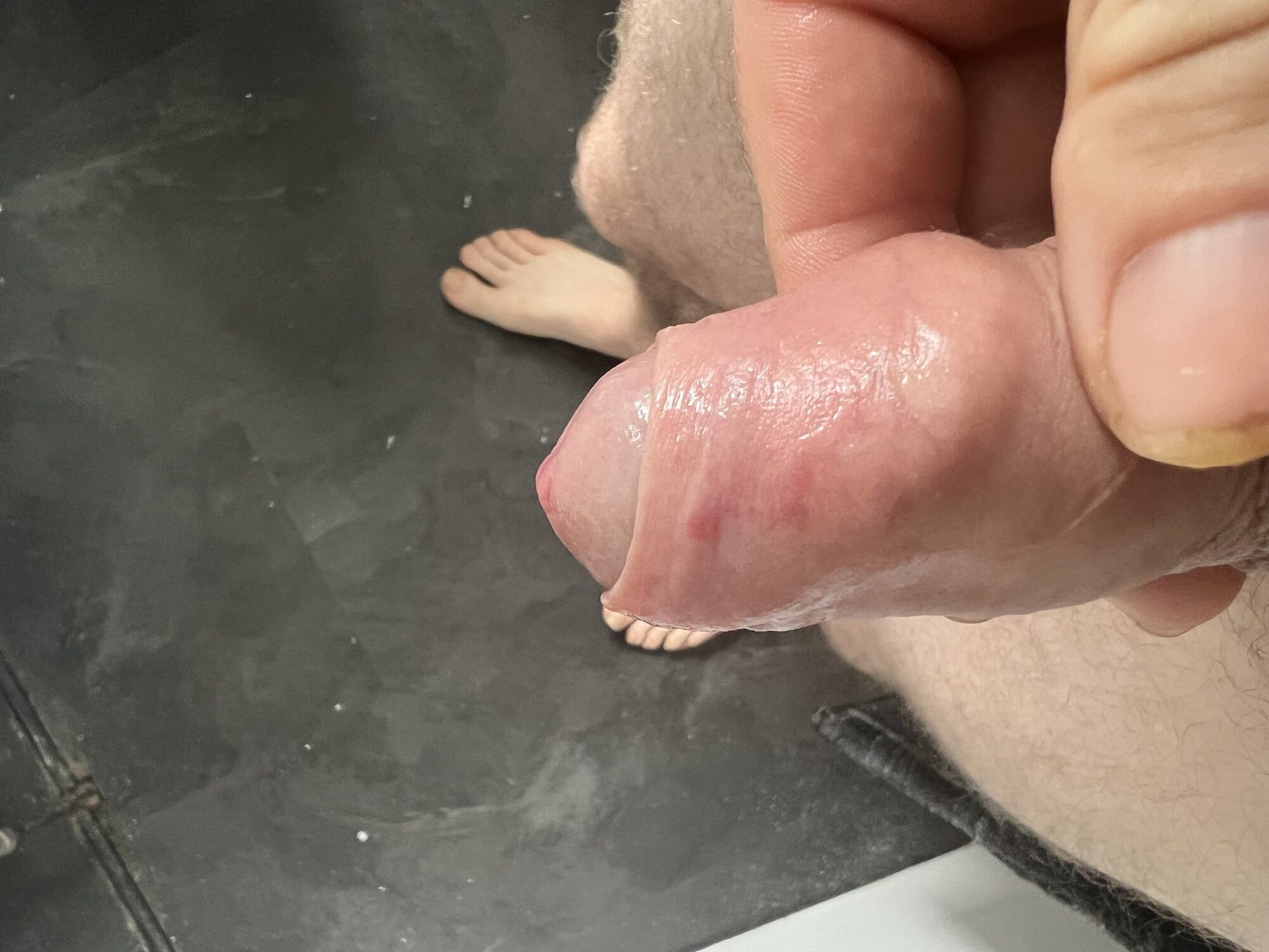 Bruised cock #11