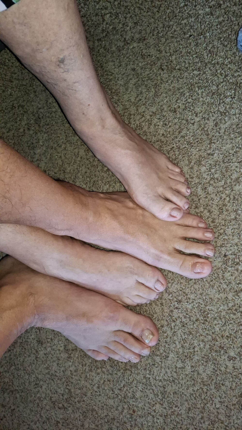 Showing off our un polished toes #8