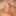 Tiny Dick, Micropenis  #2