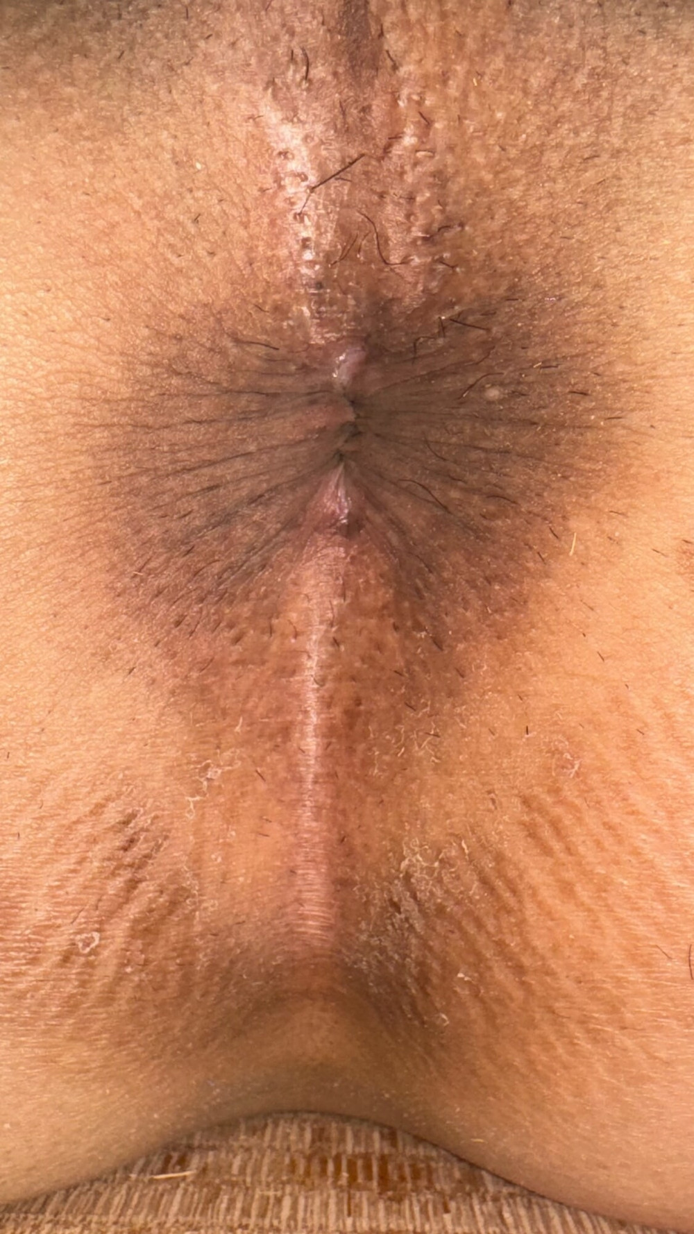 my  anus #31