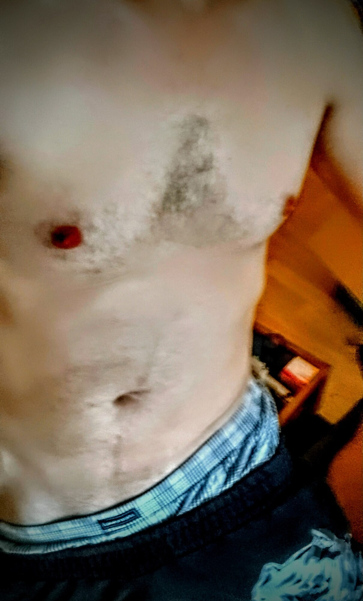 ....