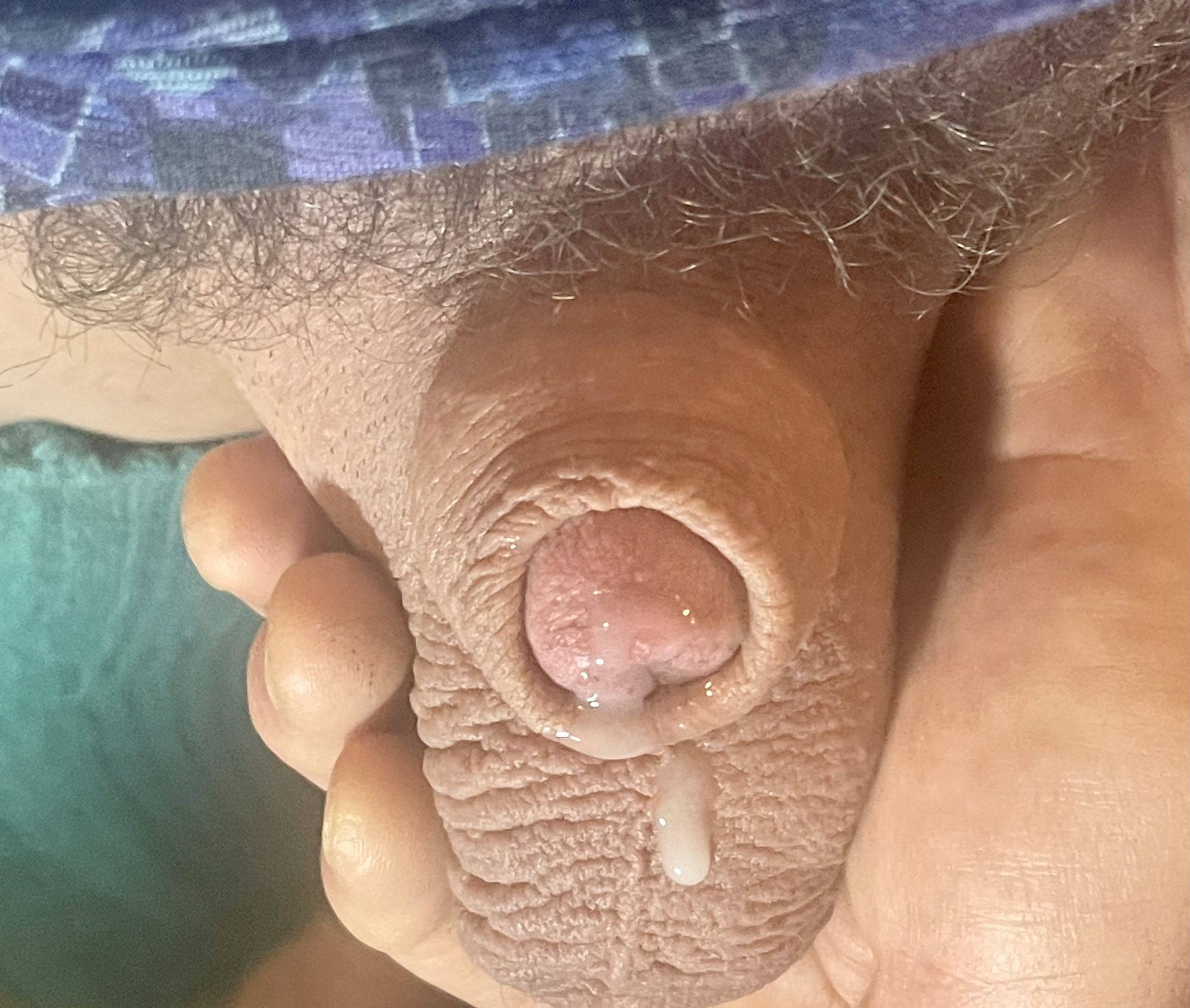 Micropenis lady, boy, cock pic #14