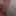 My Dick