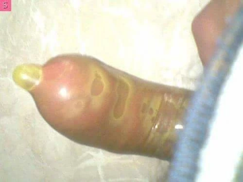 May dick #32