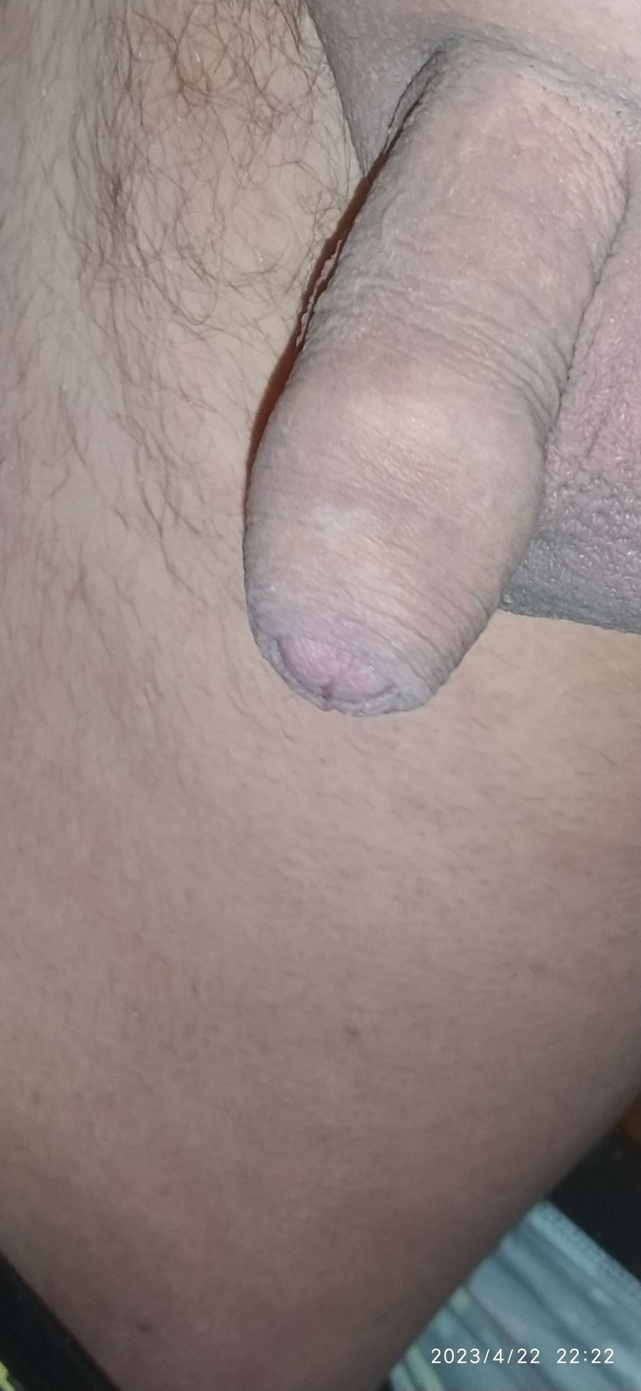 my penis