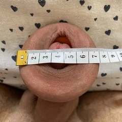 Extreme foreskin stretching