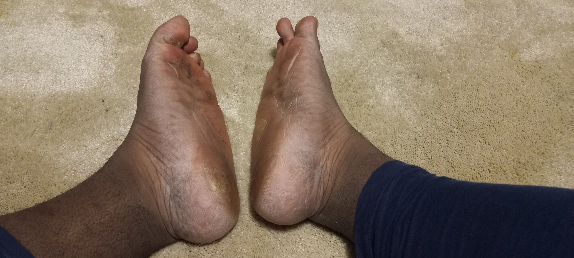 Pics of my Feet #23
