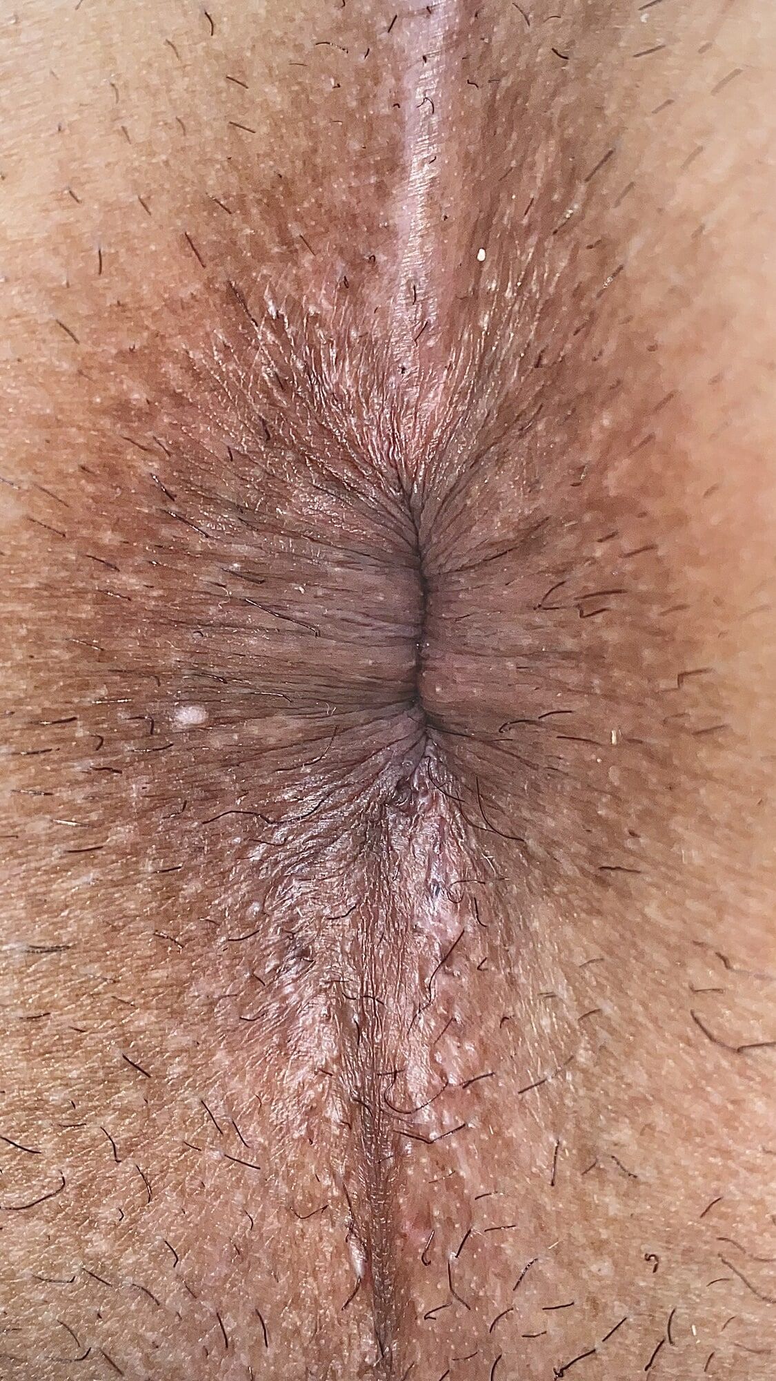 Close-up of a man's anus