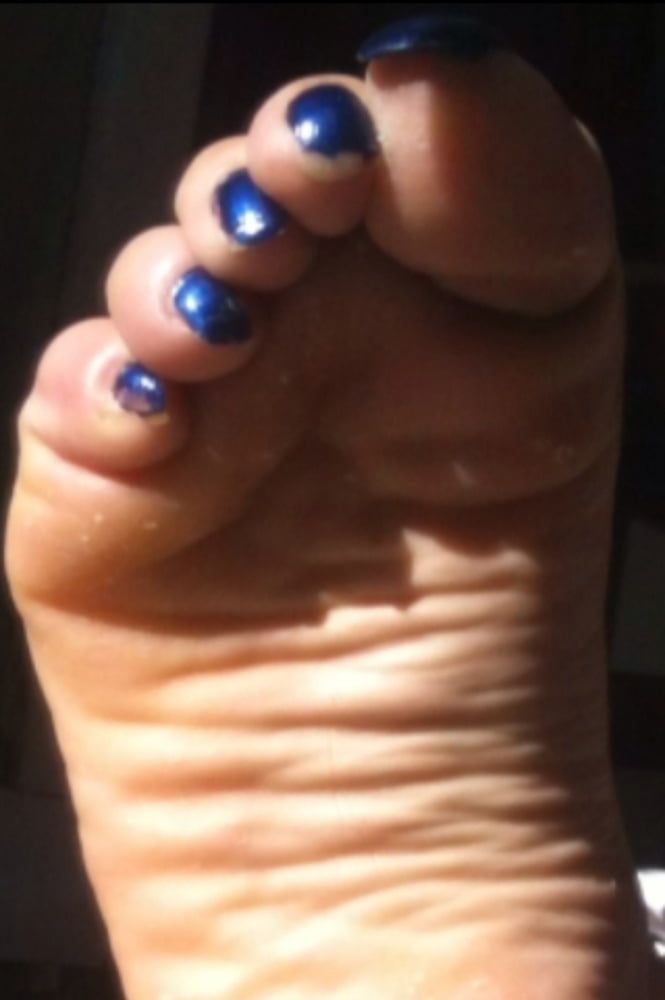Blue toenails under sun ray #8