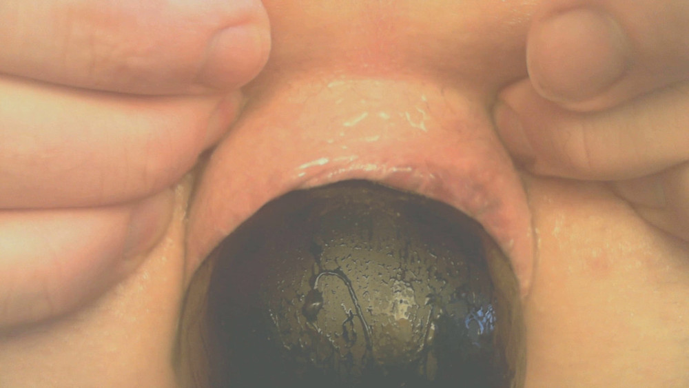 my butthole under pressure #5