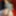 Bruised Redhead Ass from XHamster Live Show - Week 207 #12