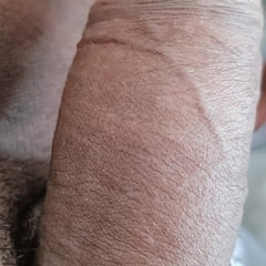 迪克
