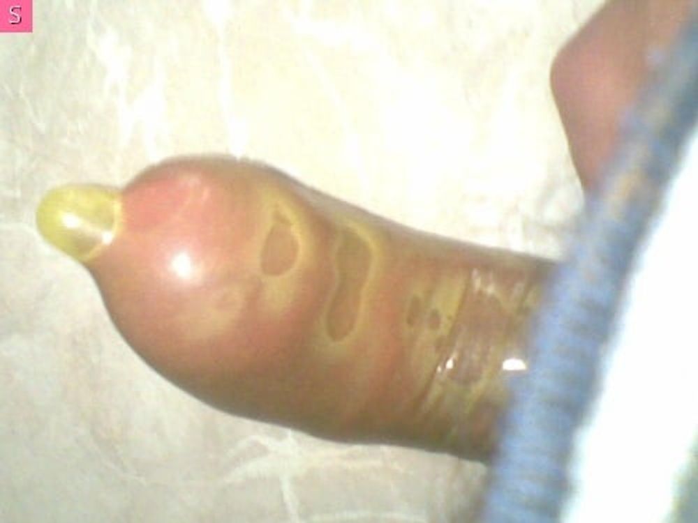 dick  #28