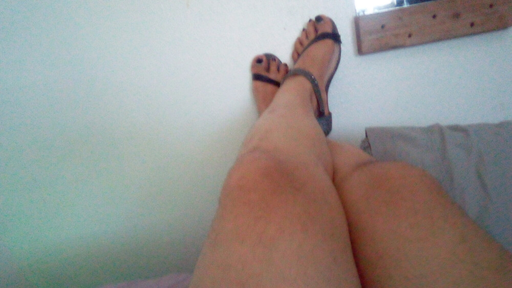 Overhanging toes, ankle straps, toe spreading.  #7
