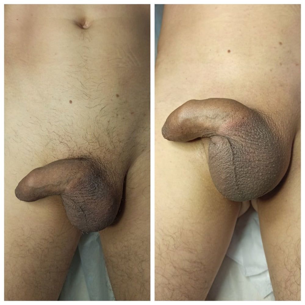 Look! After my procedure, all the dicks really got bigger!  #22