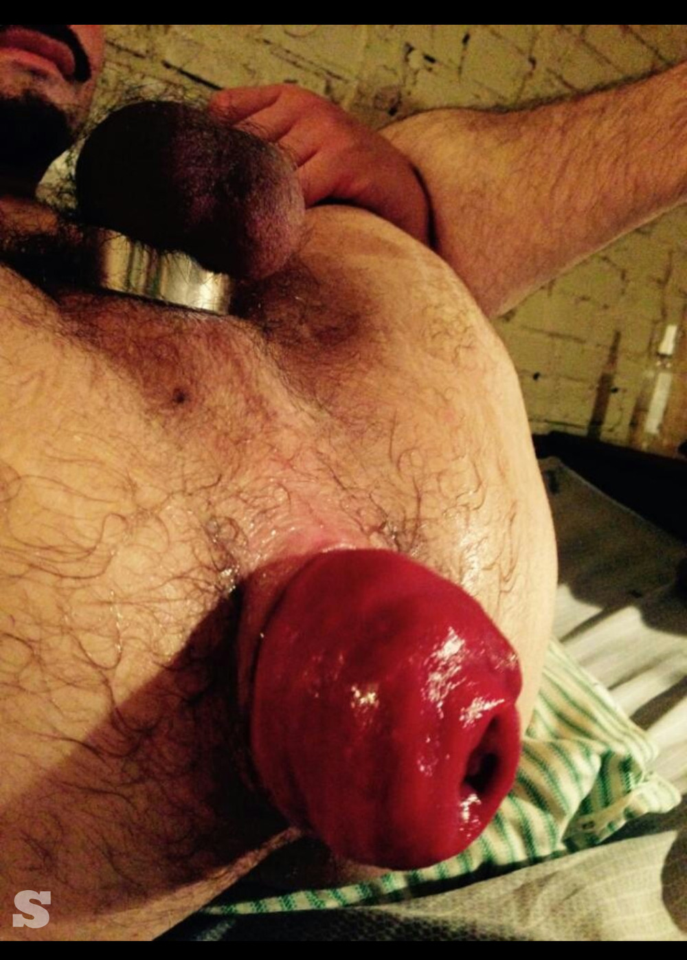 Rosebuds, Prolapse, Dildos and My love for them. #15