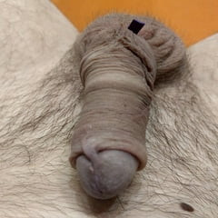 Limb cock banding