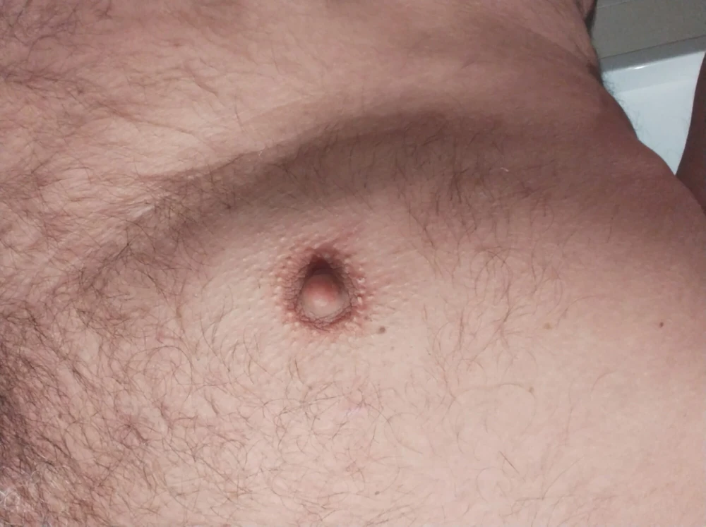 Nippel #4