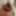 Extreme foreskin stretching porn #2