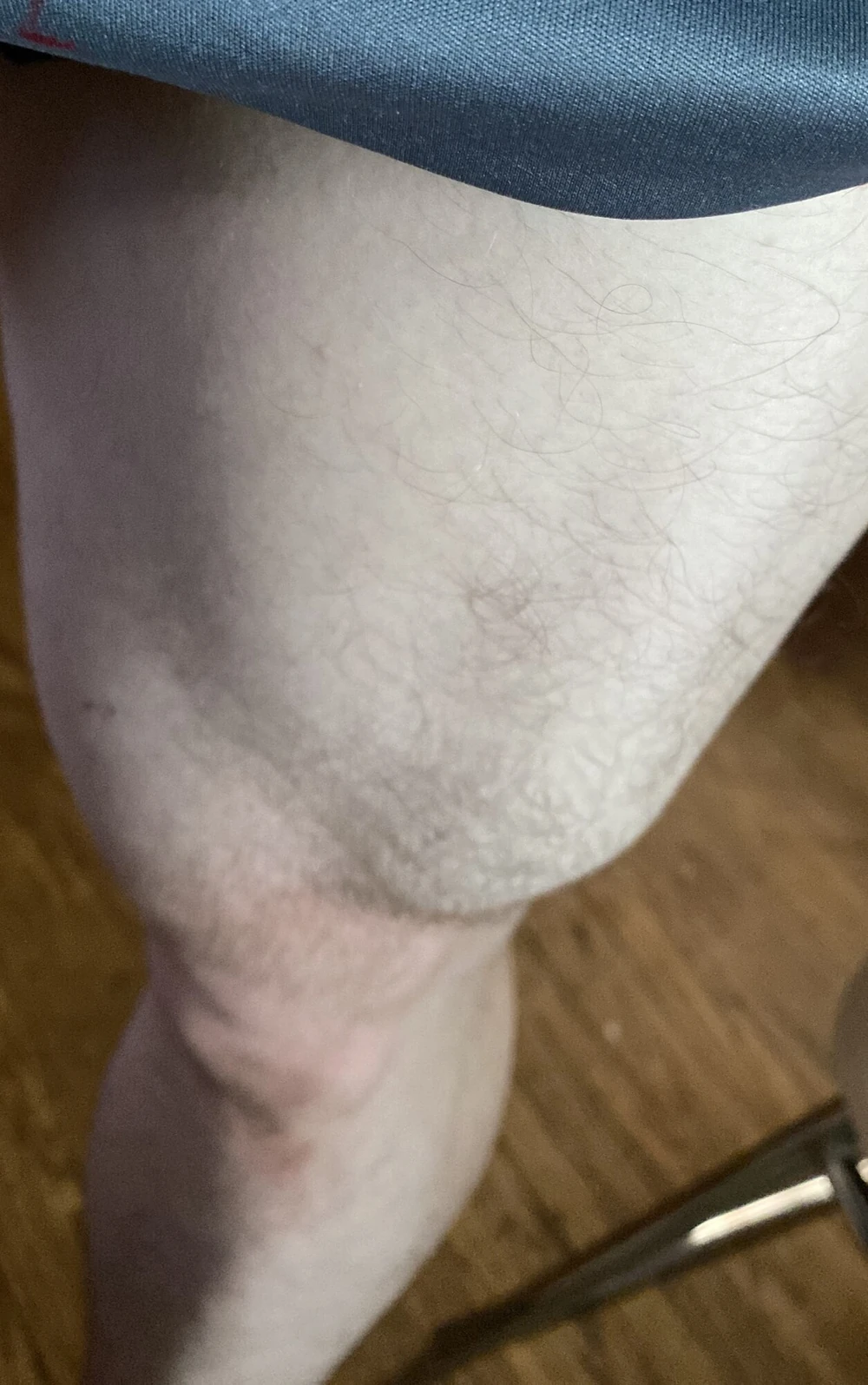 Naelor Legs  #2