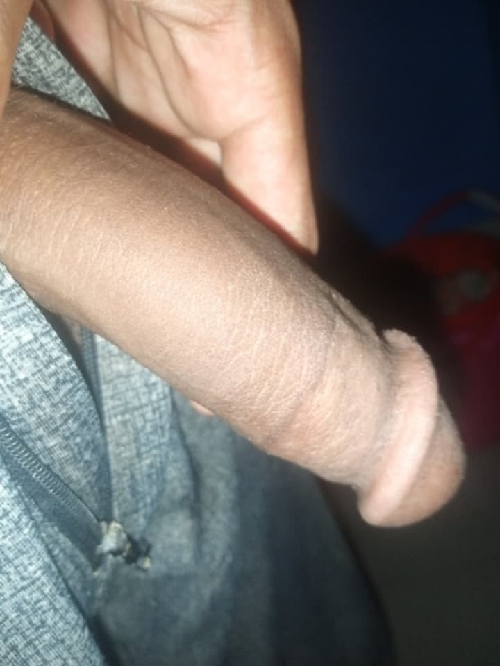 Lollipop 