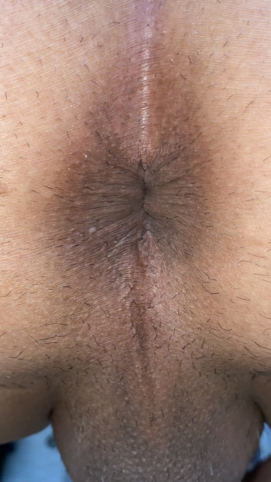 Close-up of a man's anus #2