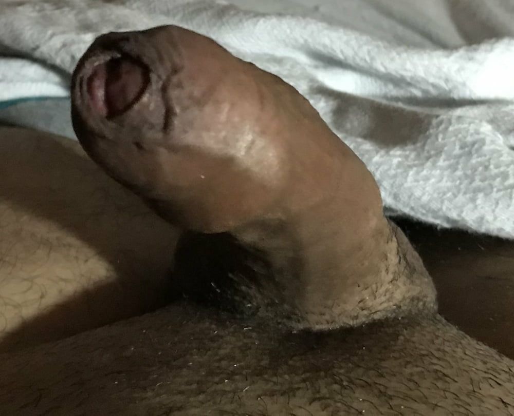 My foreskin up