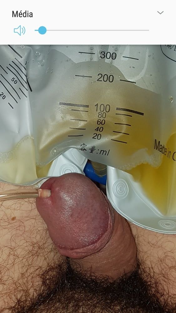 Catheter sounding with my urine 2 #25