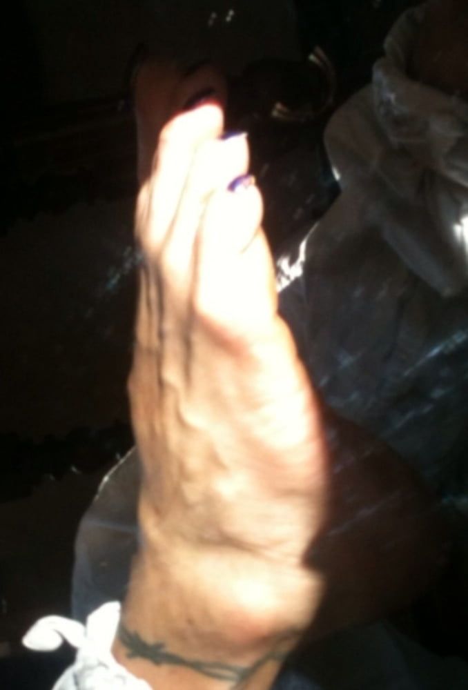 Blue toenails under sun ray #11