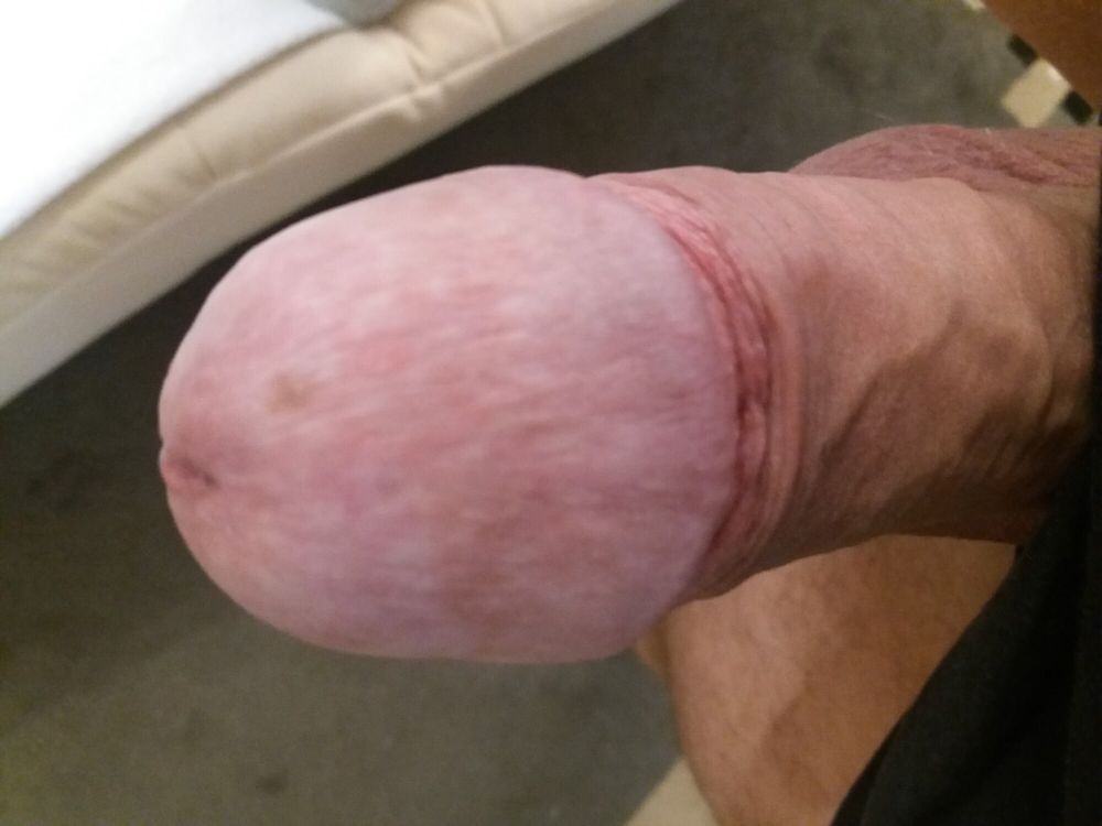 My dick #15