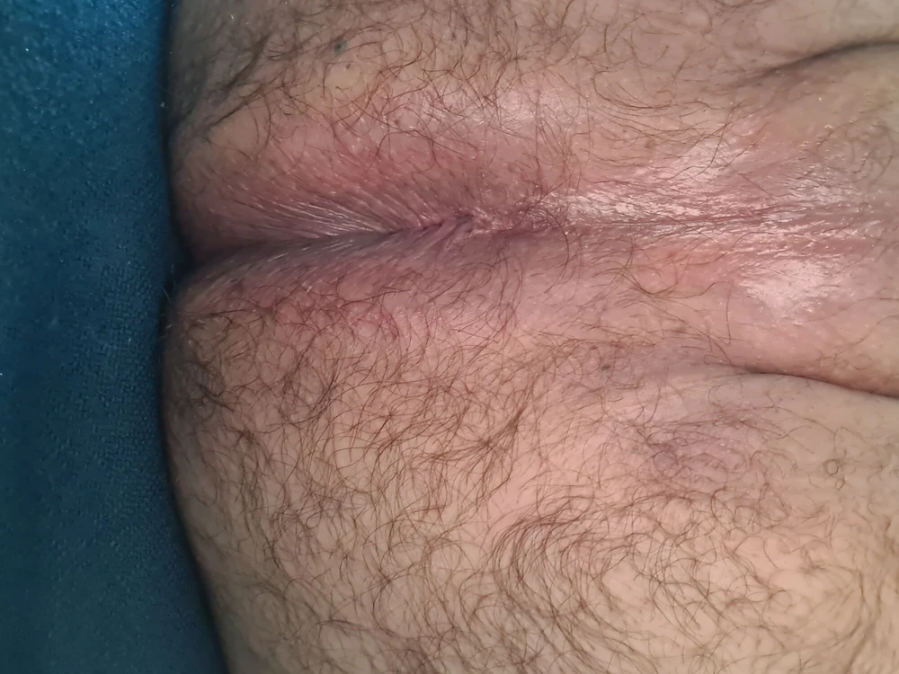 foto4