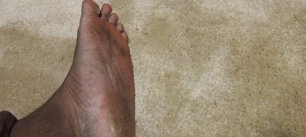 Pics of my Feet #13