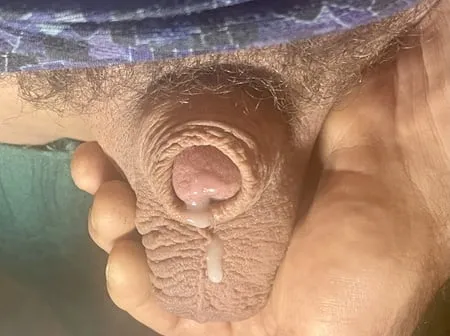 micropenis lady boy cock pic         