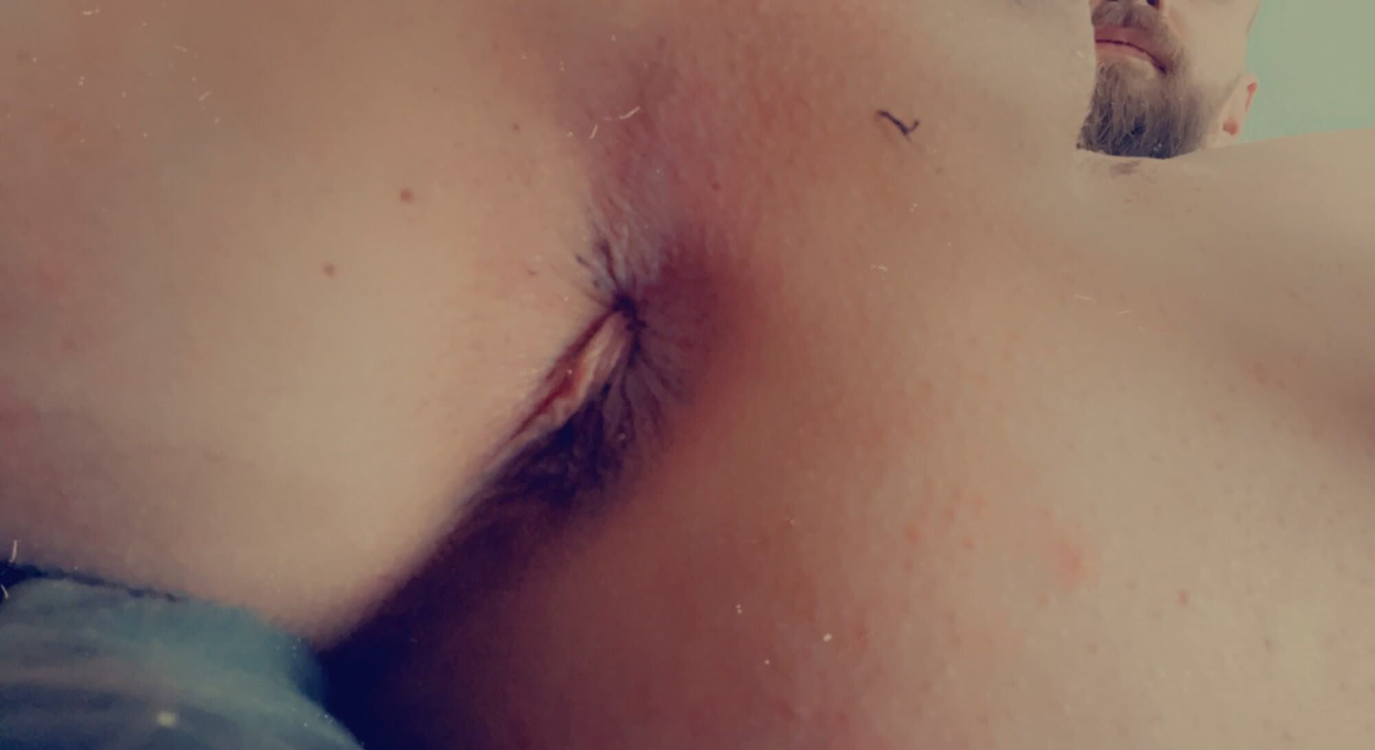 Mee #17