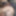 Teaser