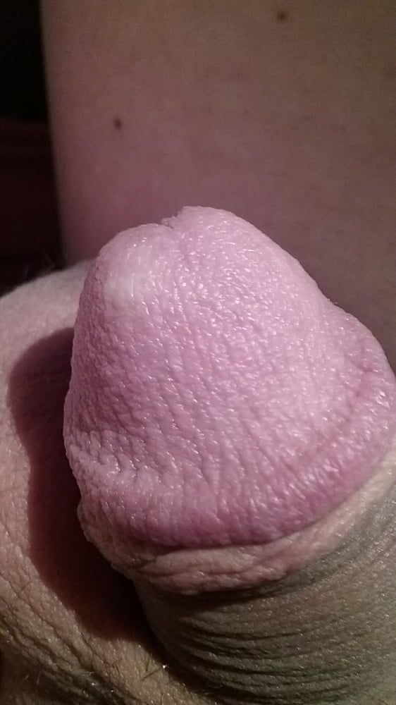 My circumcised penis new pics #5