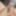 Saline Foreskin
