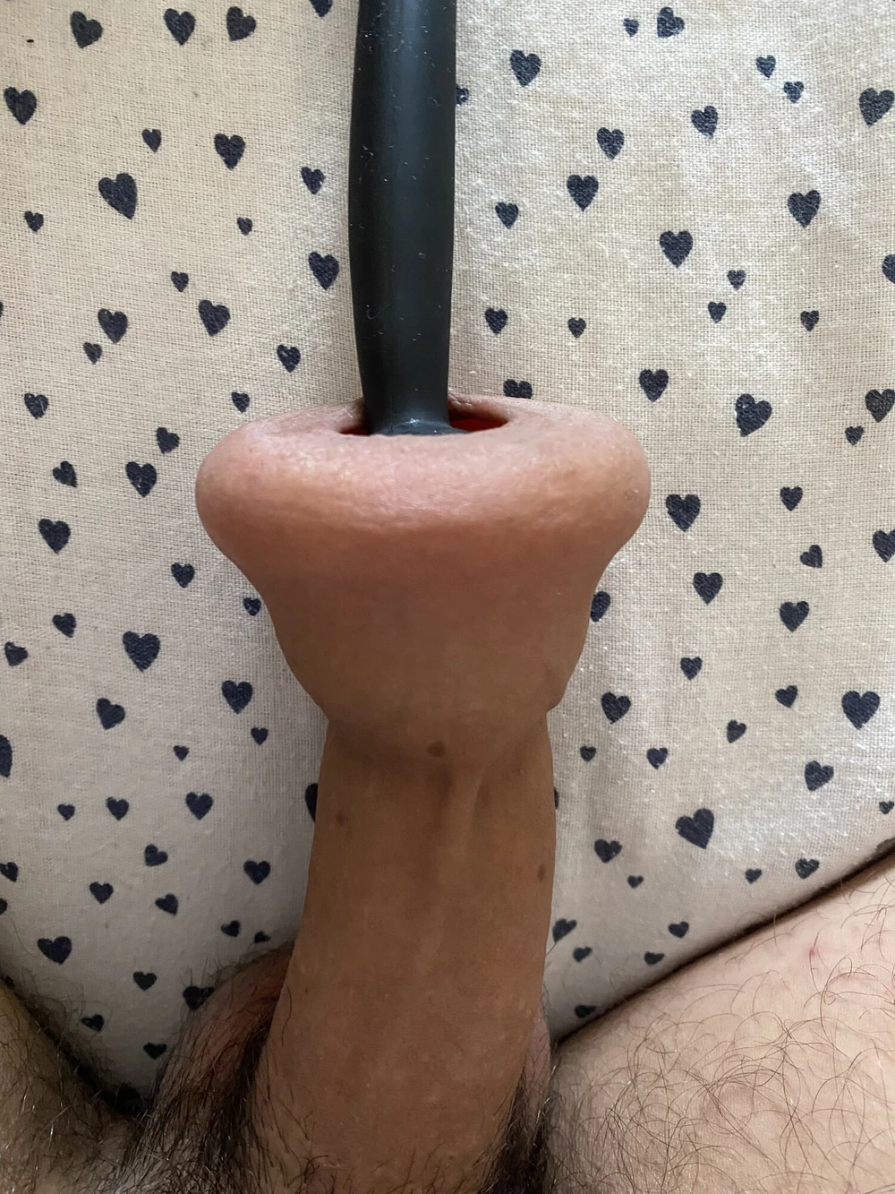 Extreme foreskin inflation #2