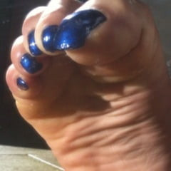 Blue toenails under sun ray