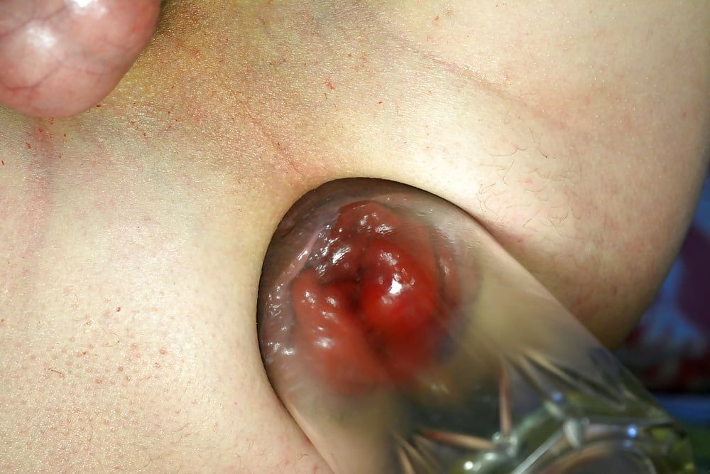 extreme prolapse pumping #52
