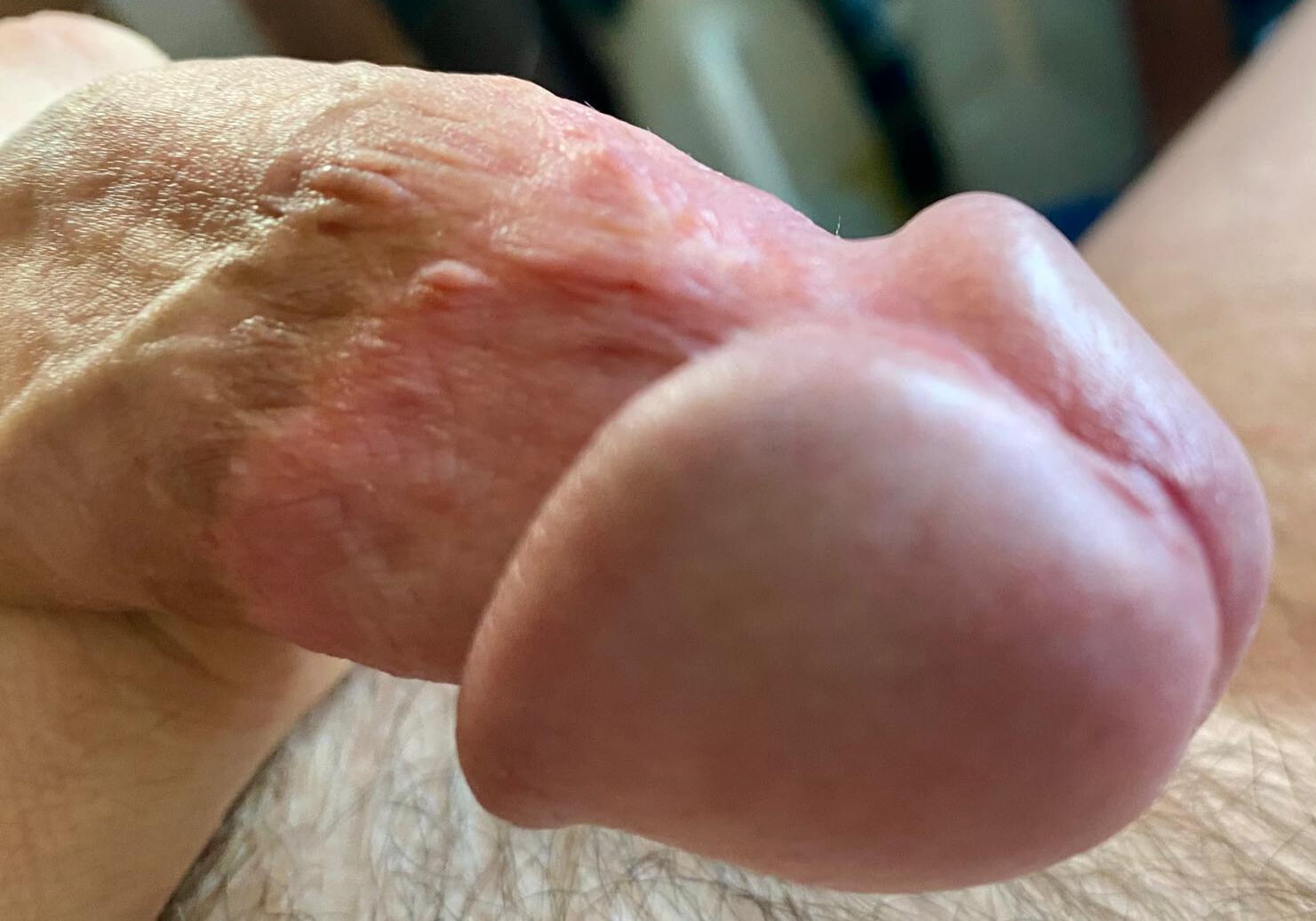 Needs attention #8